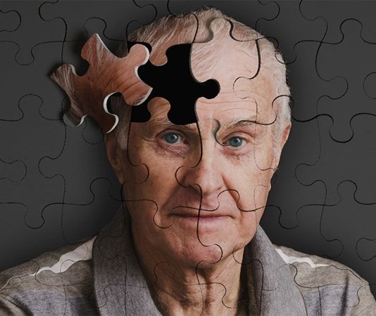 Alzheimer Önleyici MIND Diyeti Zihinsel Sağlığı Destekleyen Beslenme Yaklaşımı Yaşlanmayla birlikte bilişsel işlevlerde görülen gerileme, günümüzde birçok kişinin ortak kaygıları arasında yer alıyor. Özellikle Alzheimer hastalığı, hem bireyleri hem de ailelerini etkileyen önemli bir sağlık sorunu olarak öne çıkıyor. Bu noktada beslenme alışkanlıklarının beyin sağlığı üzerindeki rolü giderek daha fazla gündeme geliyor. Alzheimer önleyici MIND diyeti, zihinsel performansı desteklemeyi amaçlayan bütüncül bir beslenme yaklaşımı olarak dikkat çekiyor. Konulu bir haber görseli.