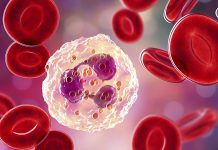 İnflamasyon, vücudun doğal savunma mekanizmasının bir parçası olsa da, kronik hale geldiğinde ciddi sağlık sorunlarına yol açabilir. Bu nedenle inflamasyon karşıtı diyet, hem inflamatuvar süreçleri azaltmak hem de genel sağlığı desteklemek için önemli bir beslenme yaklaşımı olarak öne çıkıyor. Antioksidan ve antiinflamatuvar özellik taşıyan besinlerin düzenli tüketimi, bağışıklık sistemini güçlendirir ve enerji seviyelerini dengeler. Konulu bir haber görseli.